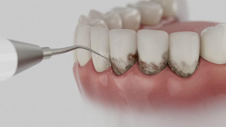 Trusted Dental Crowns And Bridges service in Maroa, IL - Dentist Open Now